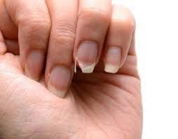 Homeopathy Medicine for Brittle Nails